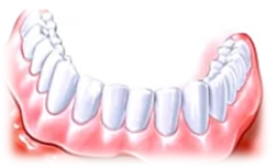 Ολικές οδοντοστοιχίες χωρίς ουρανίσκο