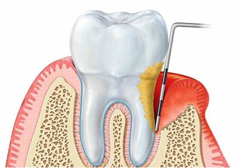 periodontologia